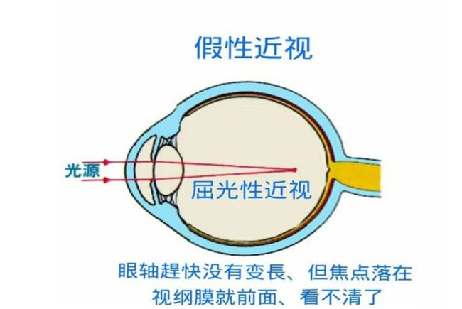 图片 4.png