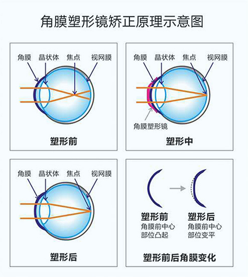 图片 2.png